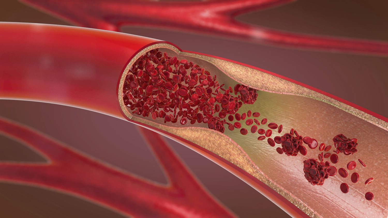 Arterial and Venous Vascular System : 